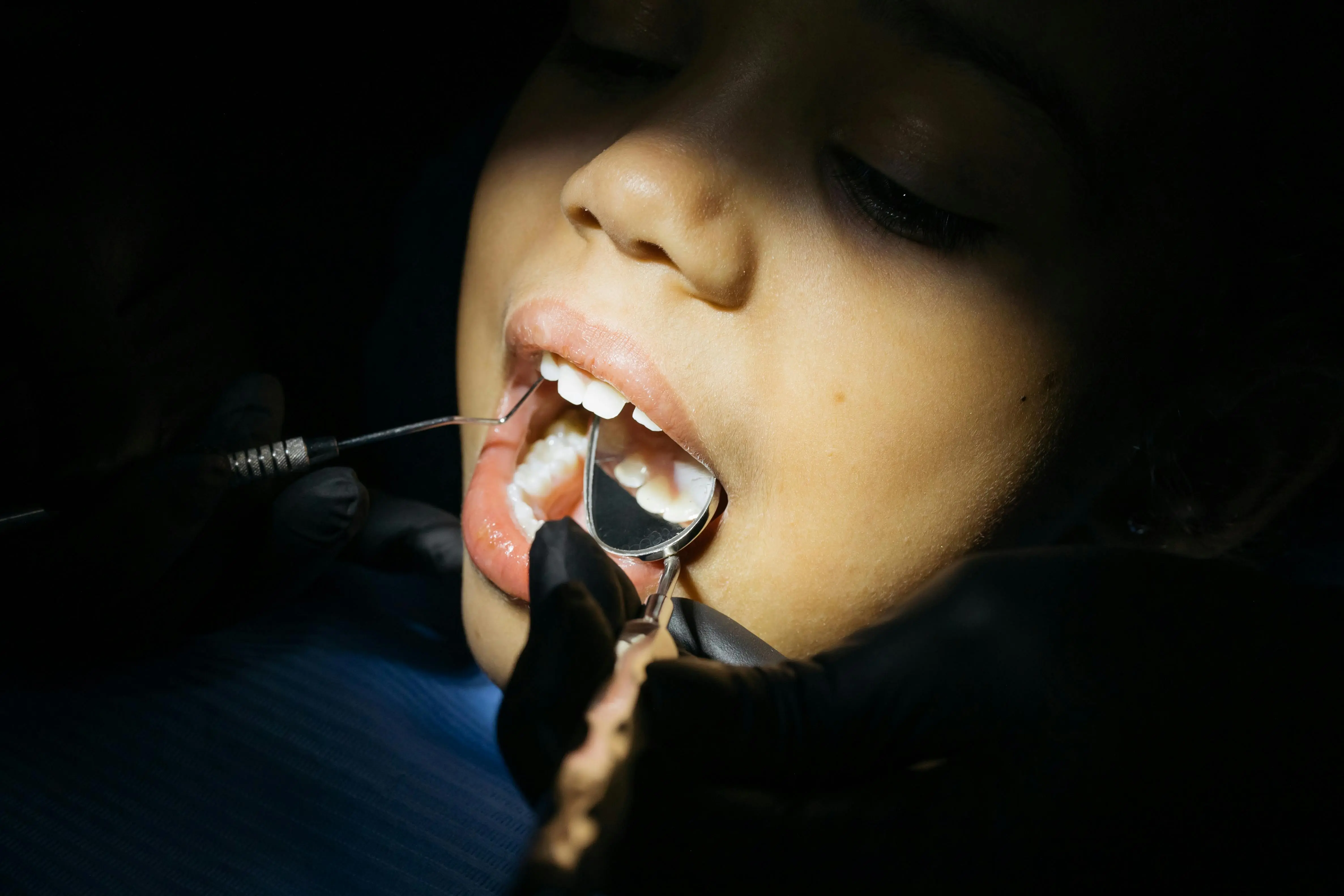 Our dentist checking for signs of gum disease